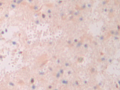 Polyclonal Antibody to Activating Transcription Factor 4 (ATF4)