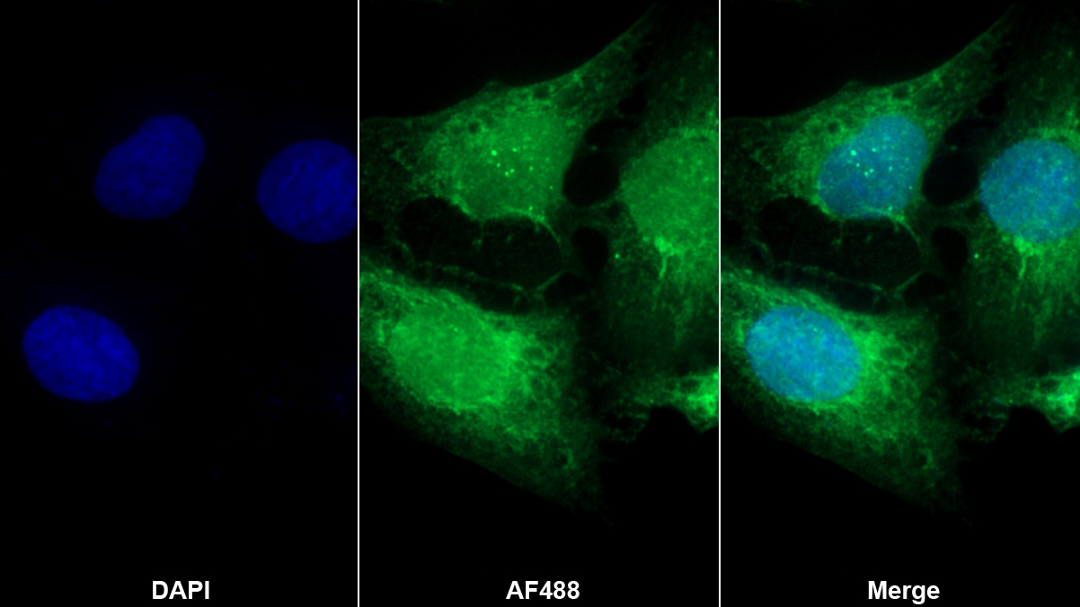 Polyclonal Antibody to Activating Transcription Factor 4 (ATF4)