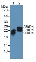 Polyclonal Antibody to Neutrophil gelatinase-associated lipocalin (NGAL)