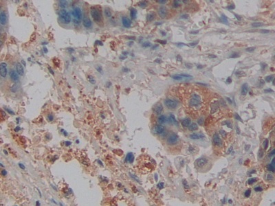 Polyclonal Antibody to Neutrophil gelatinase-associated lipocalin (NGAL)