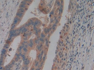 Polyclonal Antibody to Neutrophil gelatinase-associated lipocalin (NGAL)