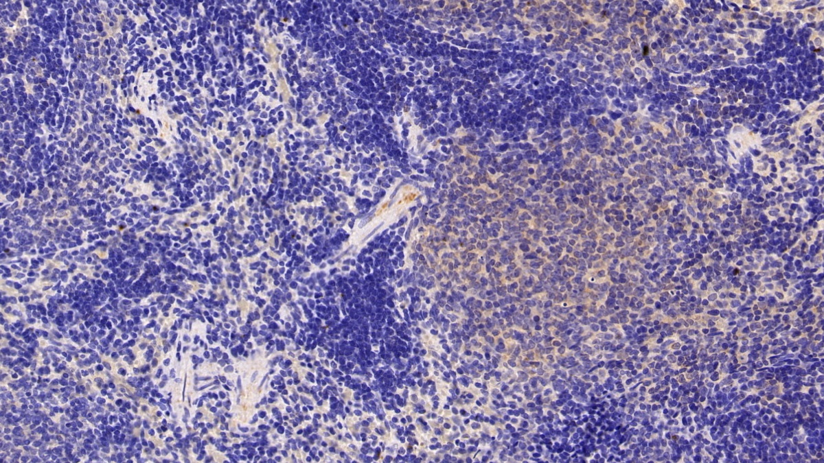 Polyclonal Antibody to Neutrophil gelatinase-associated lipocalin (NGAL)