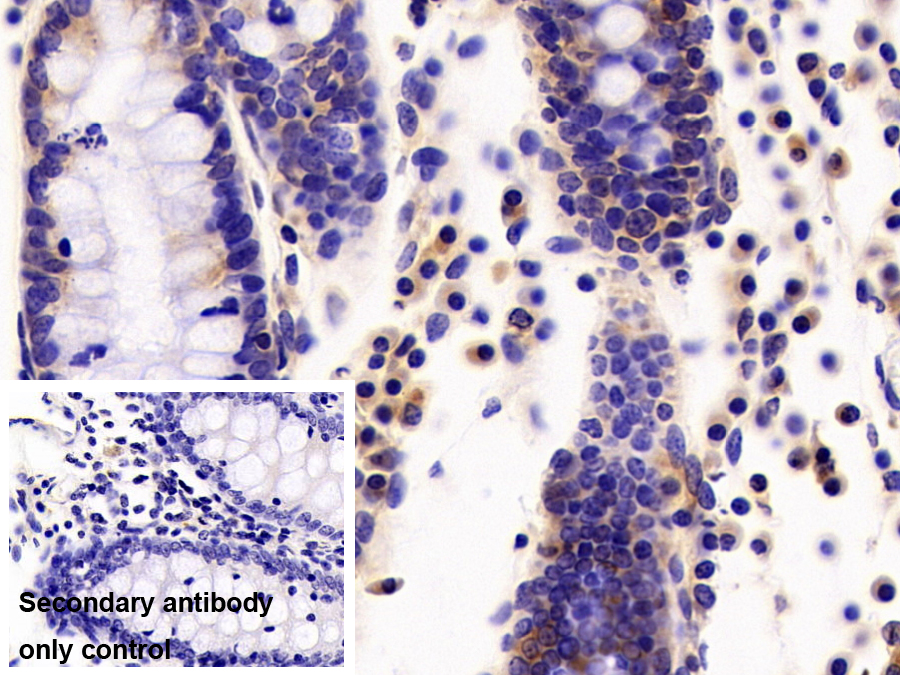 Polyclonal Antibody to Neutrophil gelatinase-associated lipocalin (NGAL)