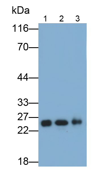 Polyclonal Antibody to Neutrophil gelatinase-associated lipocalin (NGAL)