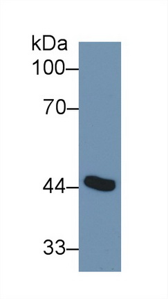 Polyclonal Antibody to Adenosine Deaminase (ADA)