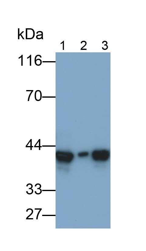 Polyclonal Antibody to Adenosine Deaminase (ADA)