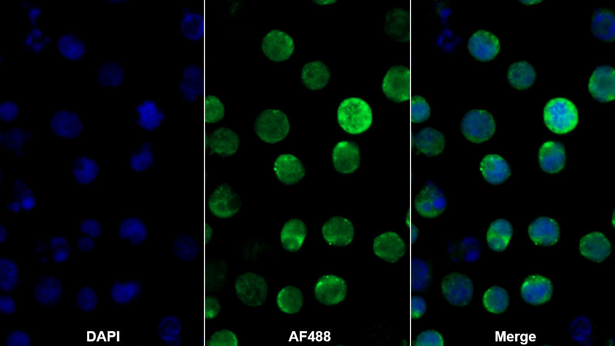 Polyclonal Antibody to Adenosine Deaminase (ADA)