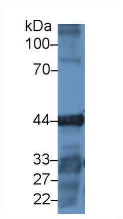 Polyclonal Antibody to Gamma Actin (ACTG)