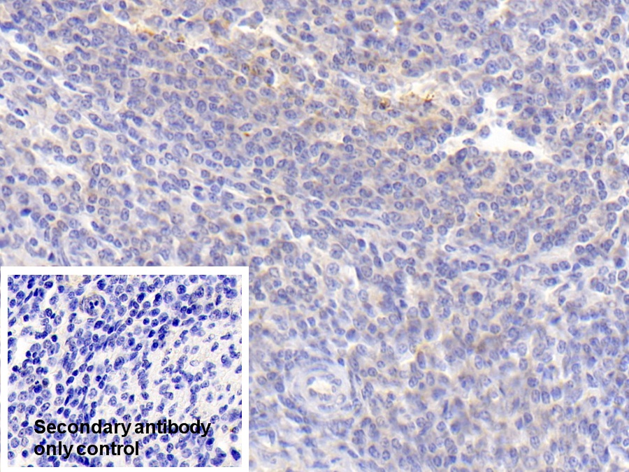 Polyclonal Antibody to Platelet Activating Factor Acetylhydrolase Ib3 (PAFAH1B3)