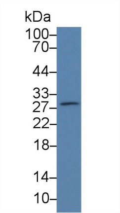 Polyclonal Antibody to Platelet Activating Factor Acetylhydrolase Ib3 (PAFAH1B3)