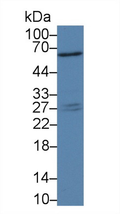 Polyclonal Antibody to Platelet Activating Factor Acetylhydrolase Ib3 (PAFAH1B3)