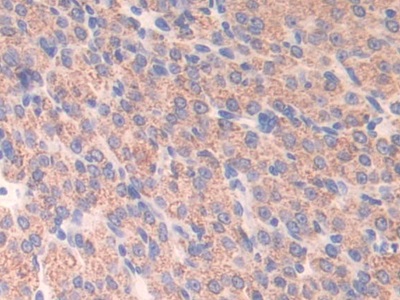 Polyclonal Antibody to Activating Transcription Factor 7 (ATF7)