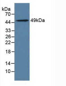 Polyclonal Antibody to Leukocyte Immunoglobulin Like Receptor Subfamily B, Member 4 (LILRB4)