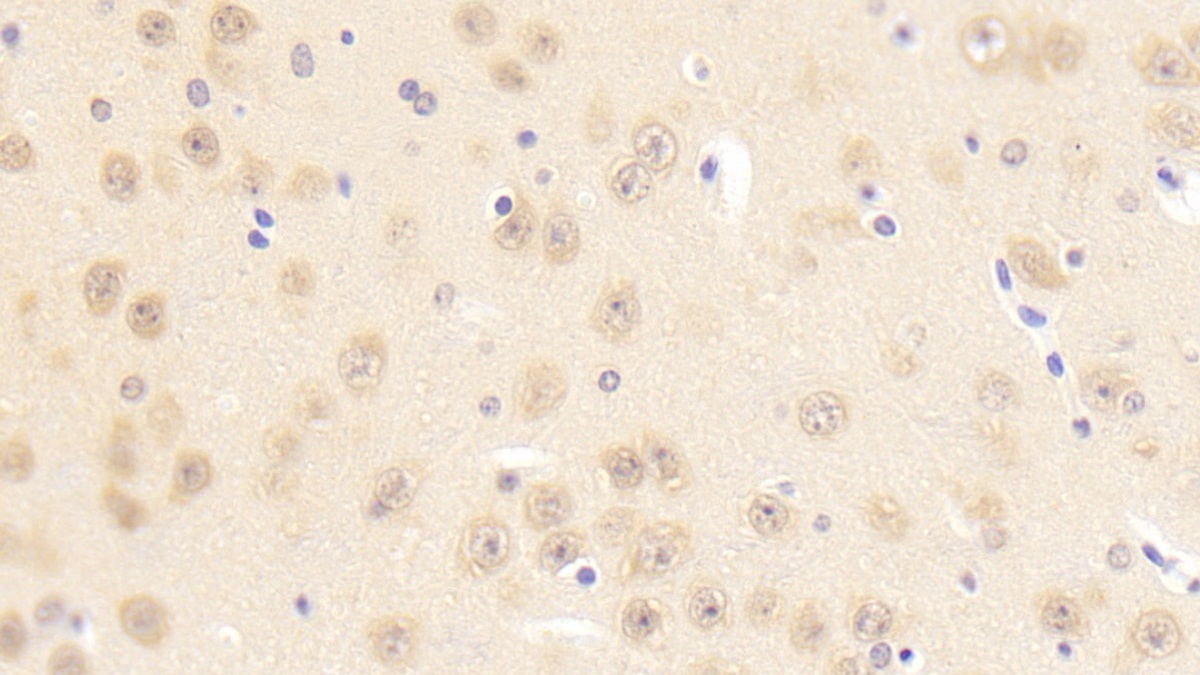 Polyclonal Antibody to Protocadherin Beta 2 (PCDHb2)