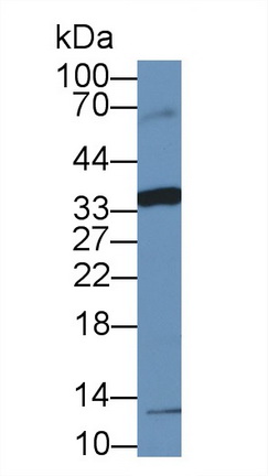 Polyclonal Antibody to Fc Fragment Of IgA Receptor (FcaR)