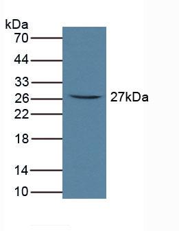 Polyclonal Antibody to Fc Fragment Of IgA Receptor (FcaR)