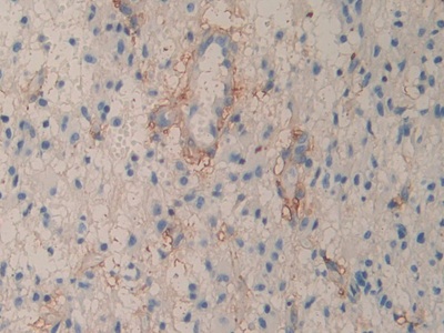 Polyclonal Antibody to Cluster of Differentiation 90 (CD90)