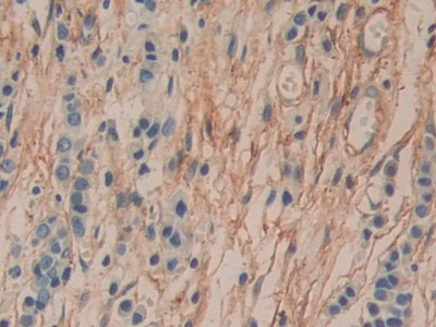 Polyclonal Antibody to Cluster of Differentiation 90 (CD90)