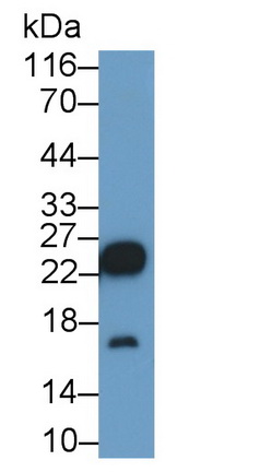 Polyclonal Antibody to Cluster of Differentiation 90 (CD90)