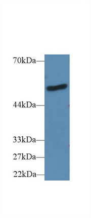 Polyclonal Antibody to Lipopolysaccharide Binding Protein (LBP)