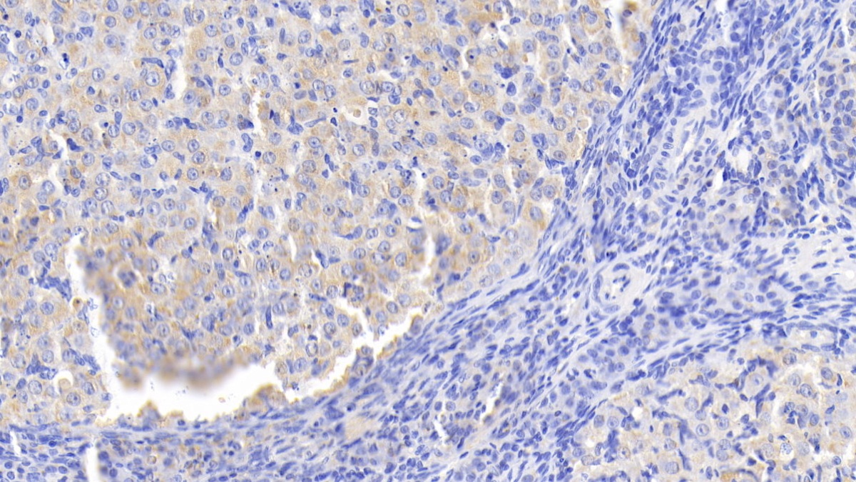 Polyclonal Antibody to Lipopolysaccharide Binding Protein (LBP)