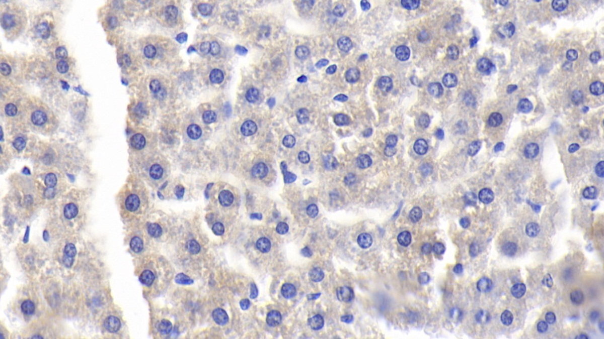 Polyclonal Antibody to Lipopolysaccharide Binding Protein (LBP)