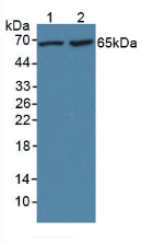 Polyclonal Antibody to Lipopolysaccharide Binding Protein (LBP)