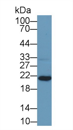 Polyclonal Antibody to Killer Cell Lectin Like Receptor Subfamily D, Member 1 (KLRD1)