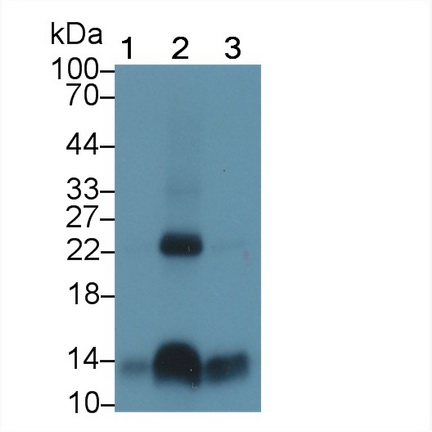 Polyclonal Antibody to Hemoglobin (HB)