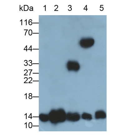 Polyclonal Antibody to Hemoglobin (HB)