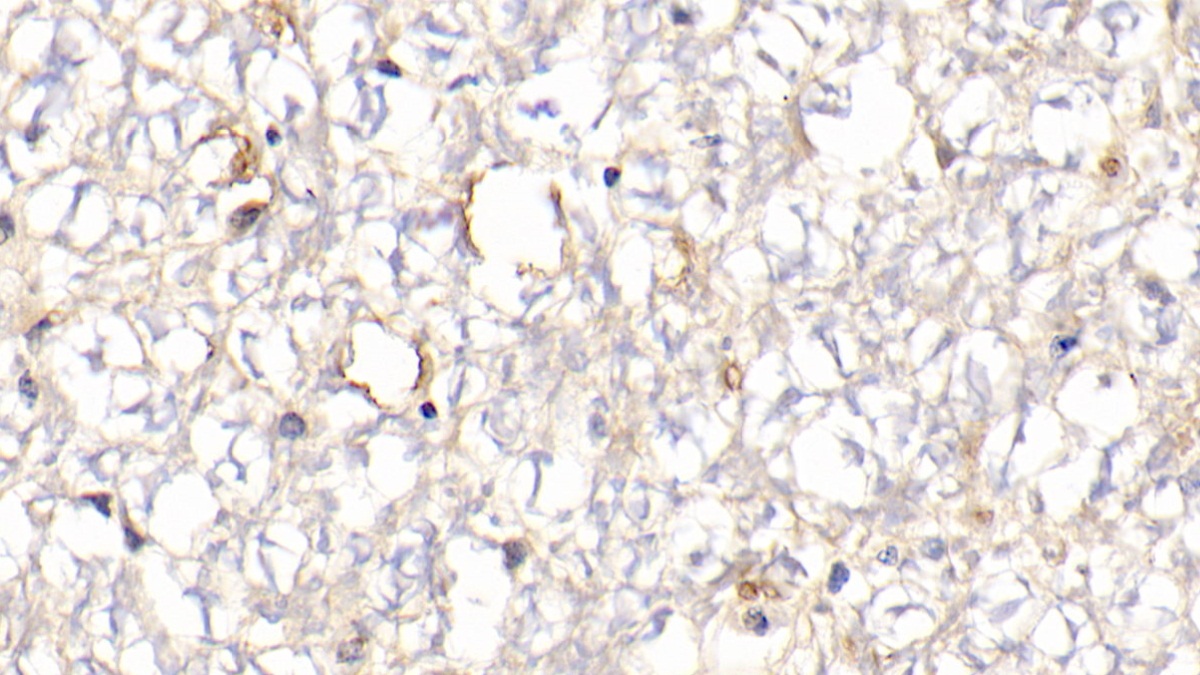 Polyclonal Antibody to Hemoglobin (HB)