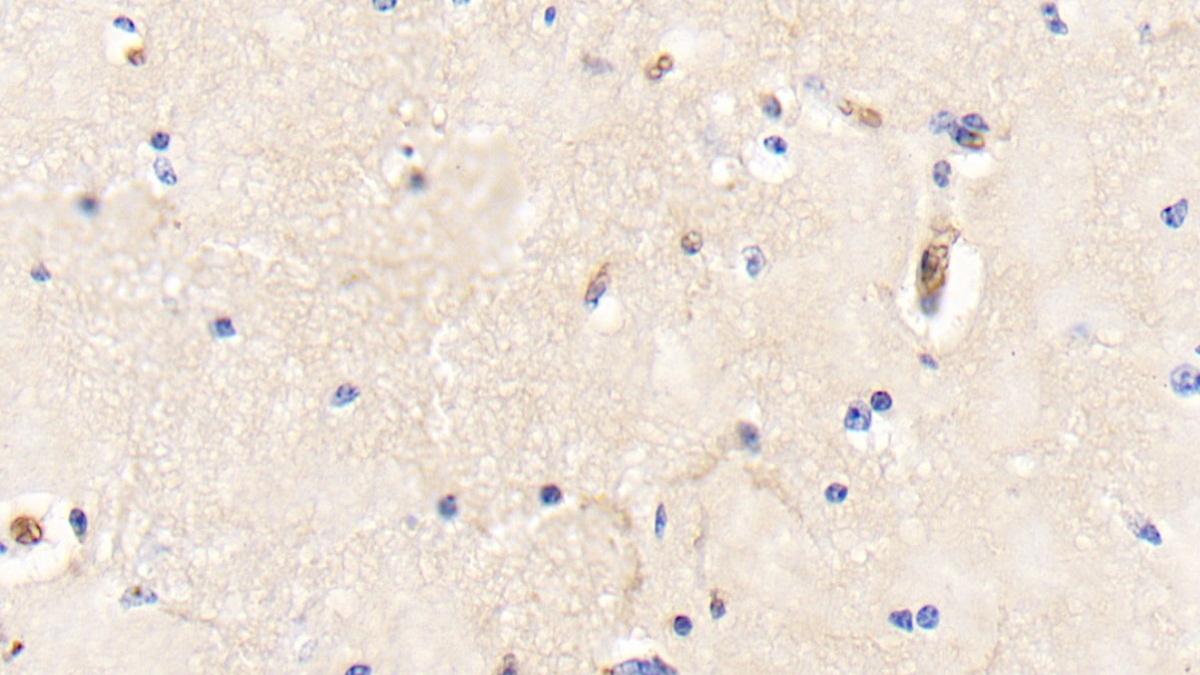 Polyclonal Antibody to Hemoglobin (HB)