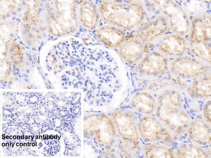 Polyclonal Antibody to Hemoglobin (HB)