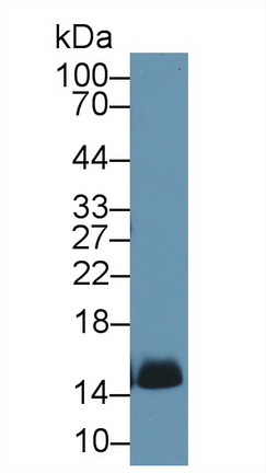 Polyclonal Antibody to Hemoglobin (HB)