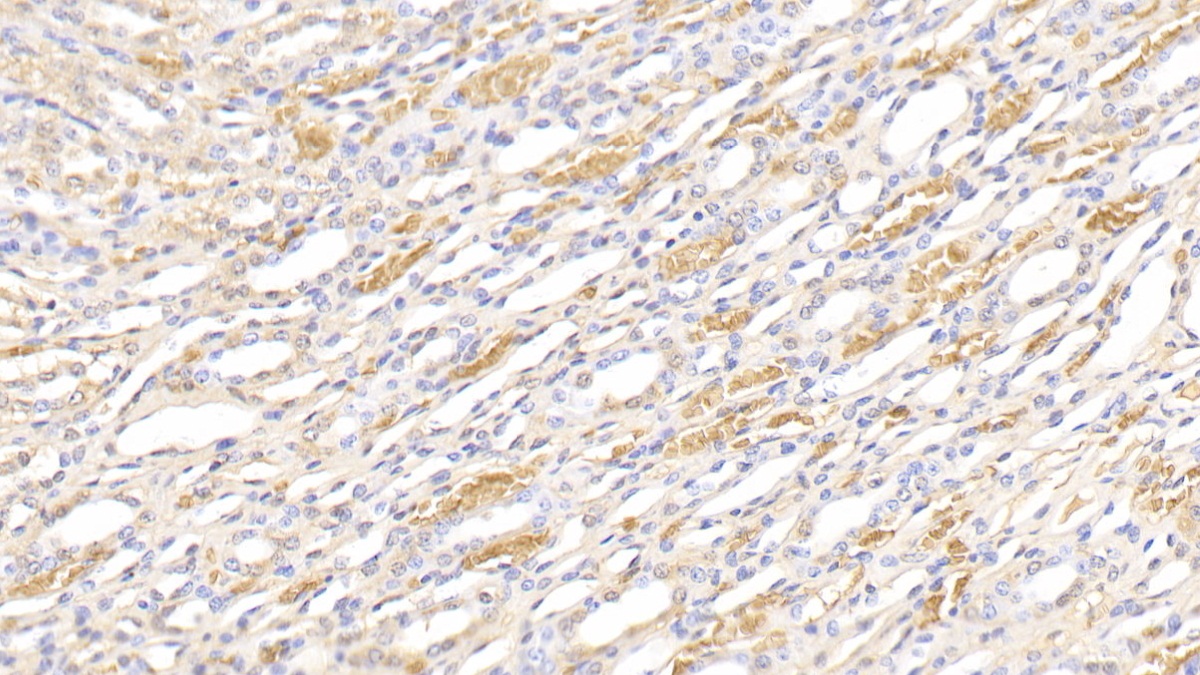 Polyclonal Antibody to Hemoglobin (HB)