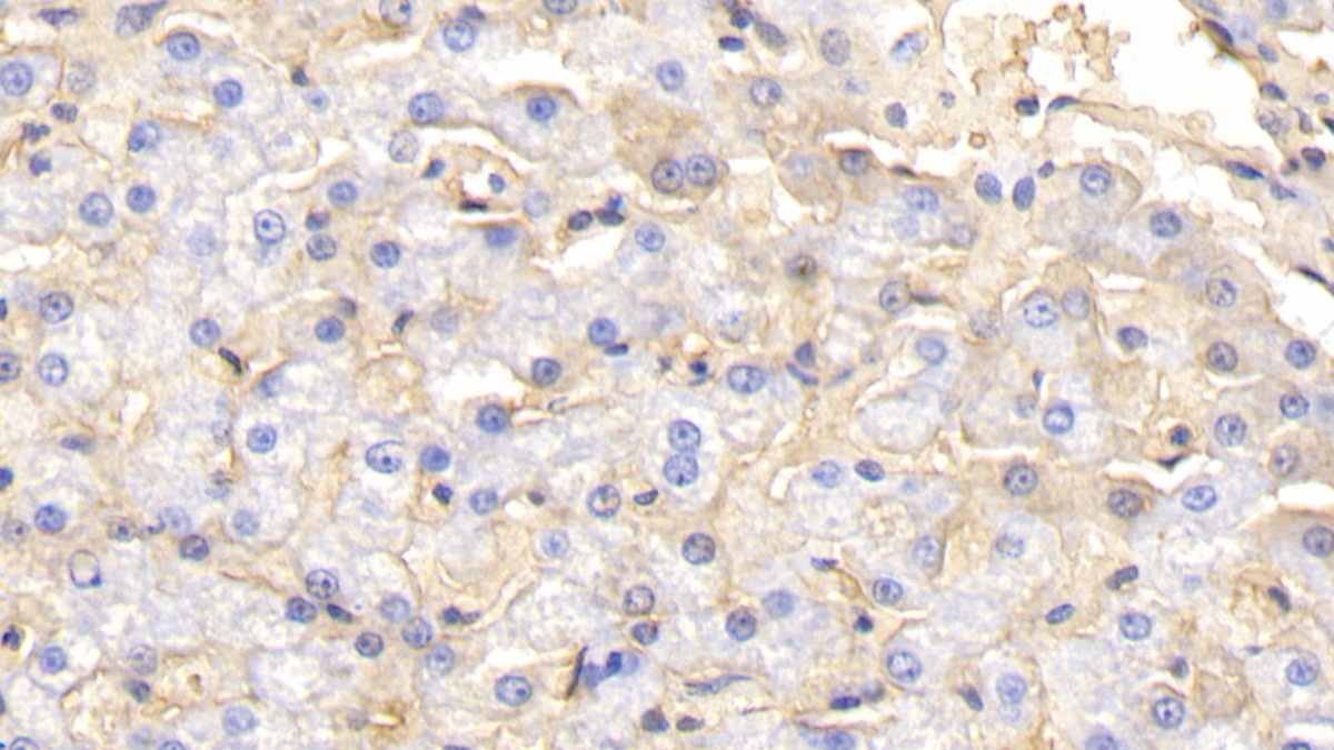 Polyclonal Antibody to Hemoglobin (HB)