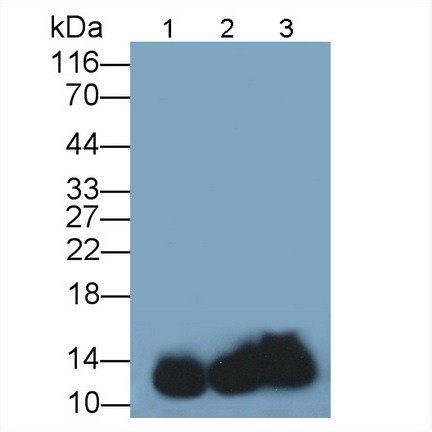 Polyclonal Antibody to Hemoglobin (HB)