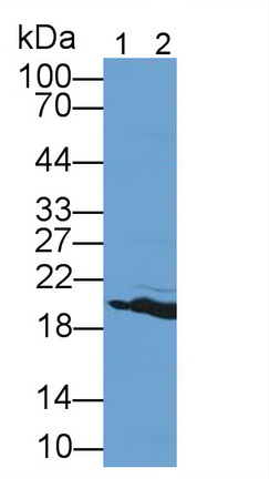 Polyclonal Antibody to Hemoglobin (HB)