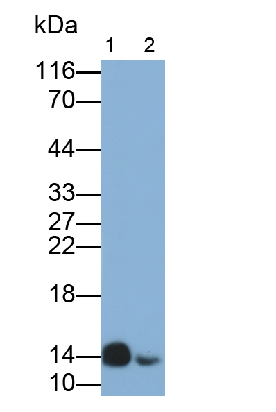 Polyclonal Antibody to Hemoglobin (HB)