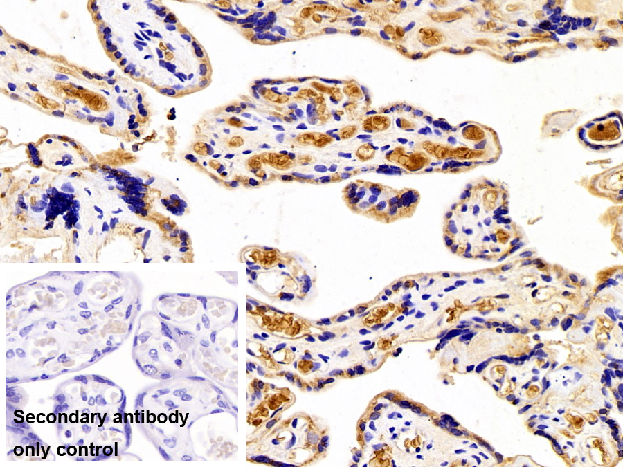 Polyclonal Antibody to Hemoglobin (HB)