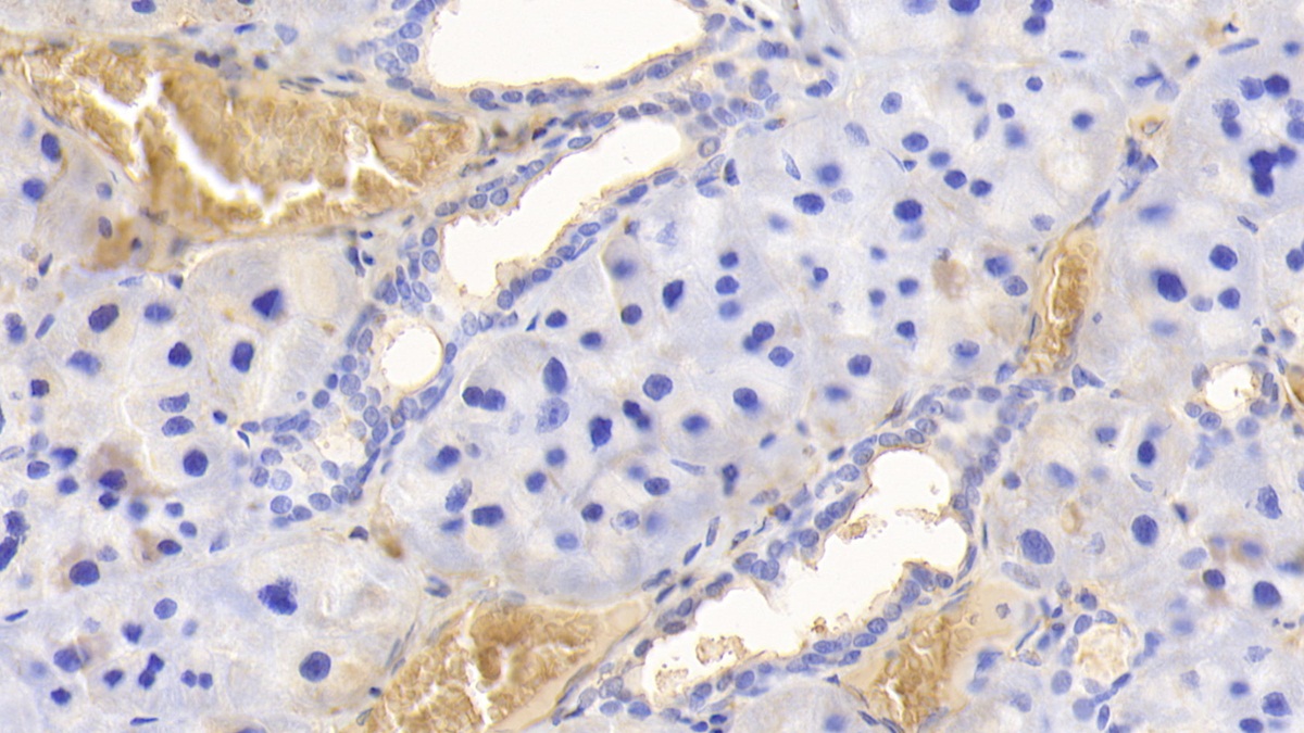 Polyclonal Antibody to Hemoglobin (HB)