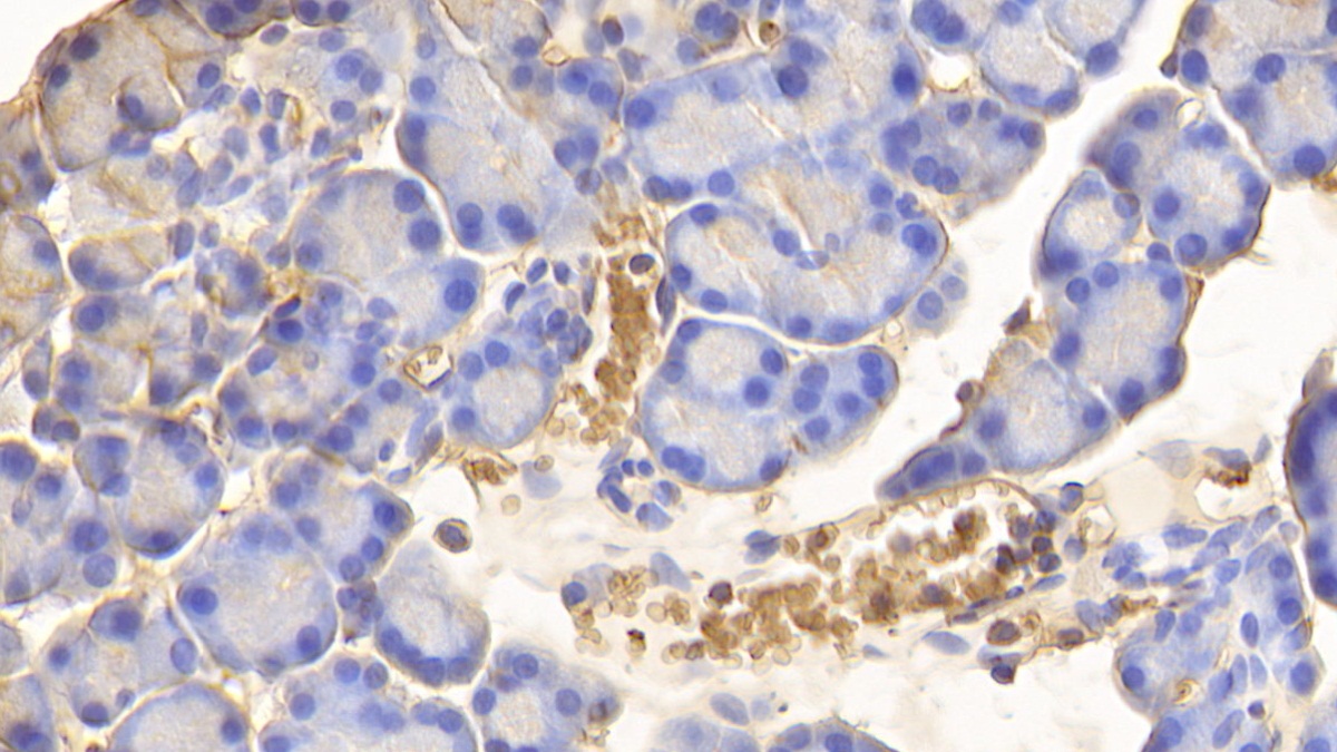 Polyclonal Antibody to Hemoglobin (HB)