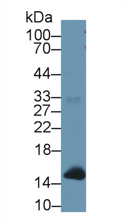 Polyclonal Antibody to Hemoglobin (HB)