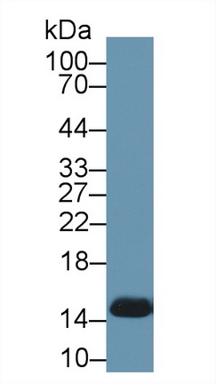 Polyclonal Antibody to Hemoglobin (HB)