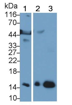 Polyclonal Antibody to Hemoglobin (HB)