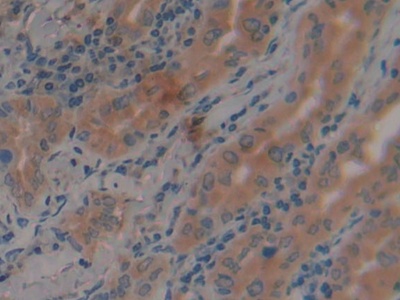 Polyclonal Antibody to Adenylate Cyclase 3 (ADCY3)