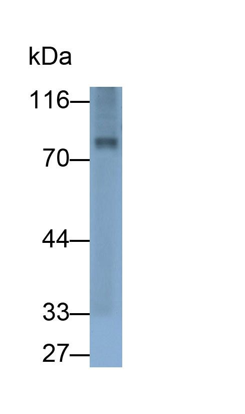 Polyclonal Antibody to Glucuronidase Beta (GUSb)