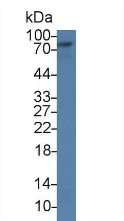 Polyclonal Antibody to Glucuronidase Beta (GUSb)