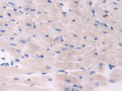 Polyclonal Antibody to Adenylate Cyclase 6 (ADCY6)