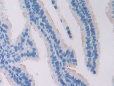 Polyclonal Antibody to Adenylate Cyclase 6 (ADCY6)